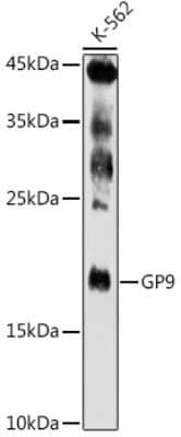 Western Blot: GP-IX Antibody [NBP3-03507] - Western blot analysis of extracts of K-562 cells, using GP-IX antibody (NBP3-03507) at 1:500 dilution. Secondary antibody: HRP Goat Anti-Rabbit IgG (H+L) at 1:10000 dilution. Lysates/proteins: 25ug per lane. Blocking buffer: 3% nonfat dry milk in TBST. Detection: ECL Enhanced Kit. Exposure time: 180s.